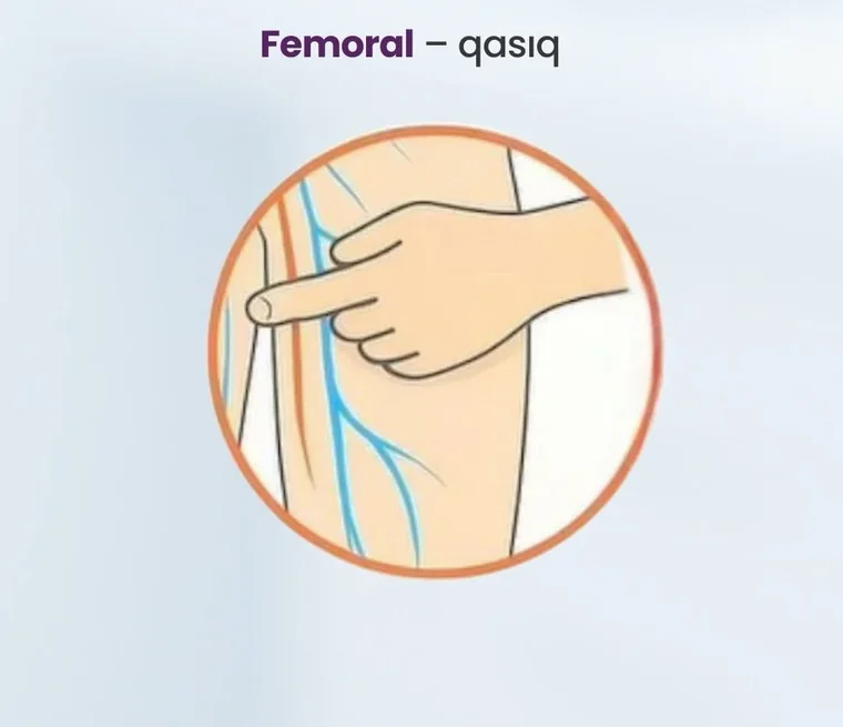 Femoral nəbz nöqtəsi — qasıq